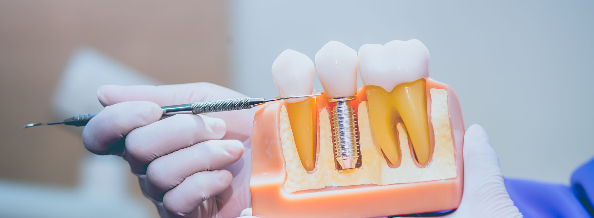 An image of a person holding a toothbrush with toothpaste over an open mouth model, showcasing dental hygiene.